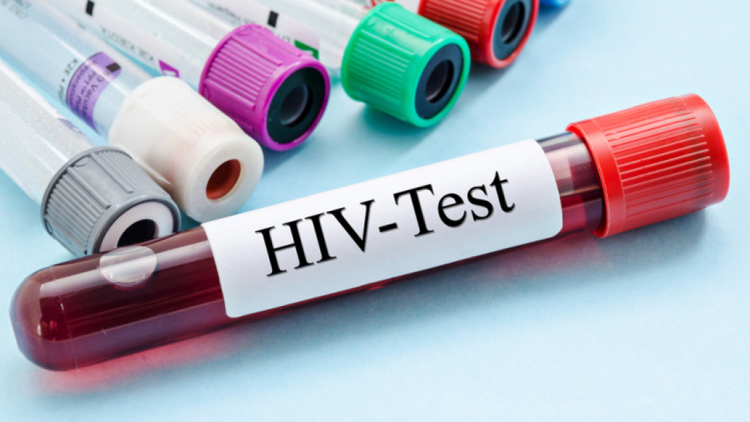O nouă speranță în tratamentul HIV: tehnologia ARNm promite eliminarea virusului